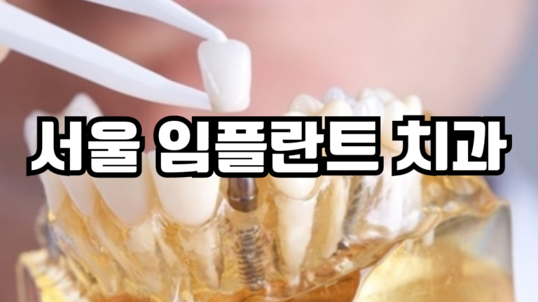 서울 임플란트 치과