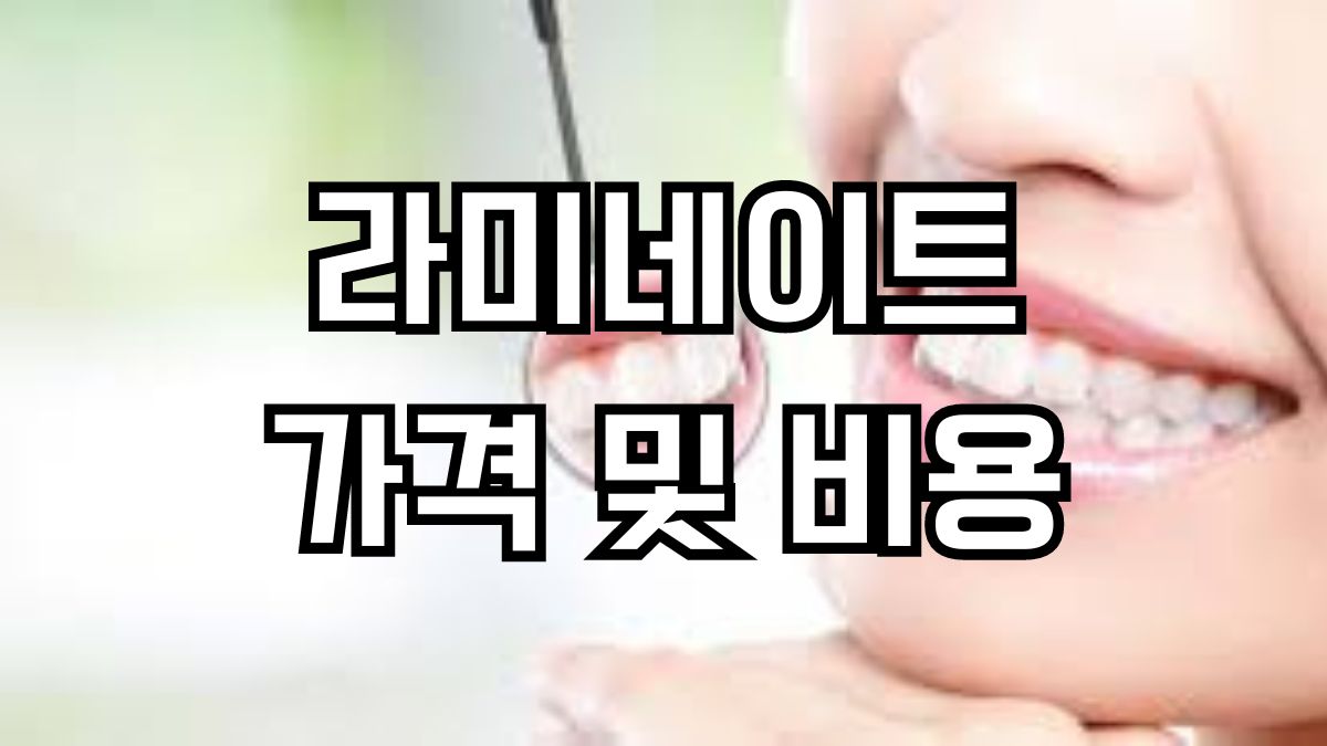 라미네이트 가격