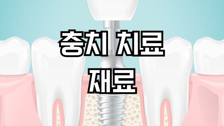 충치 치료 재료