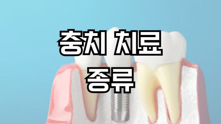 충치 치료 종류