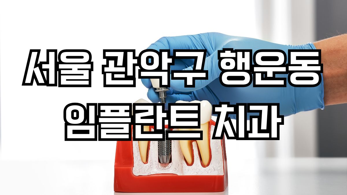 서울 관악구 행운동 임플란트