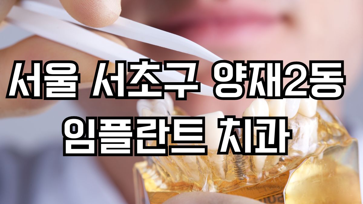 서울 서초구 양재2동 임플란트